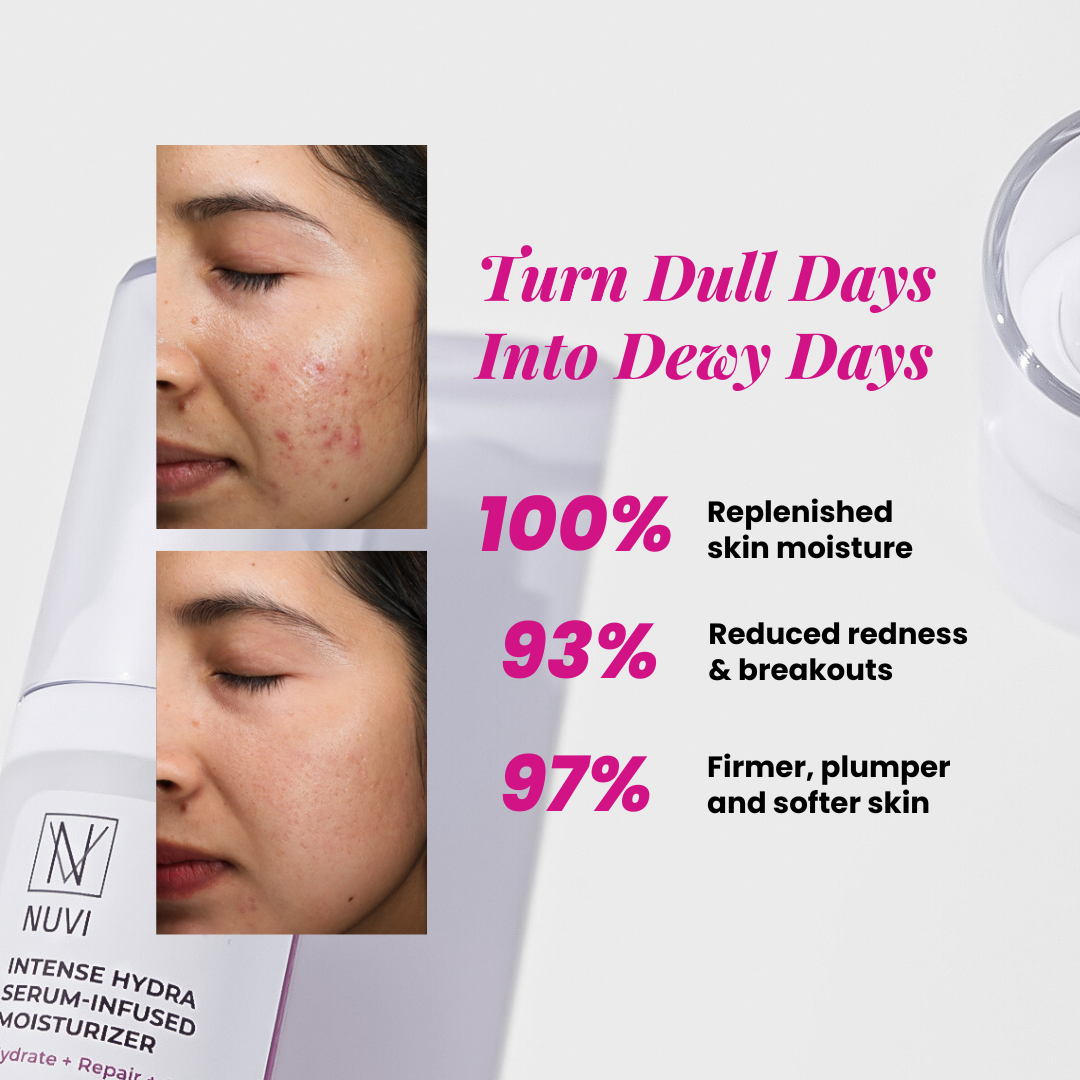 NUVI Intense Hydra Serum-Infused Moisturizer